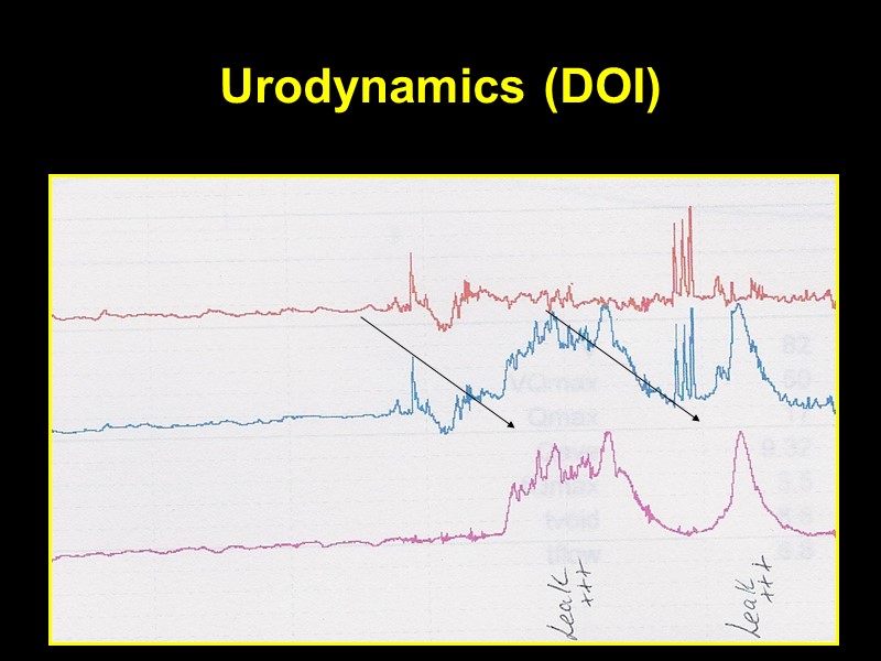 Urodynamics (DOI)